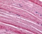 GRK5 Antibody (N-Terminus)